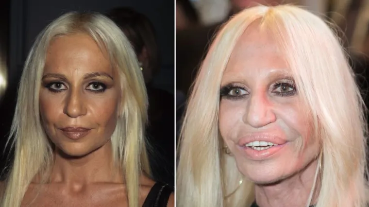 Donatella Versace napravila jednu od najvećih transformacija: Ni majka ju ne bi prepoznala