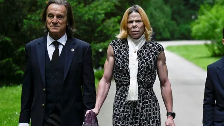 Izgubila dio nosa: Bila je princeza iz snova, a onda dobila infekciju i potpuno se deformirala