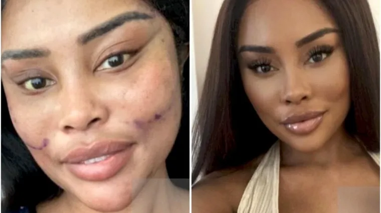 Od njezine transformacije padaju vilice: Potro&scaron;ila masnu lovu, ovako izgleda danas