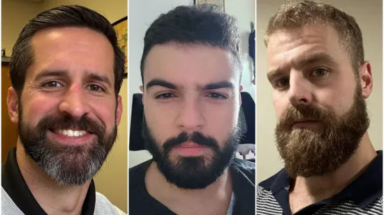 Jesu li brade mu&scaron;karcima &scaron;to i ženama &scaron;minka? Neki kada se obriju ne izgledaju kao iste osobe