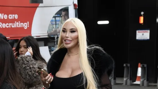 Nevjerojatna transformacija: Sad je bila uzbuđena, a pogledajte kako je prije izgledala