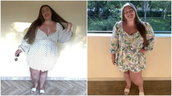 Rekli su joj da neće moći imati djecu, upla&scaron;ila se i žestoko smr&scaron;avjela: Danas je prava manekenka