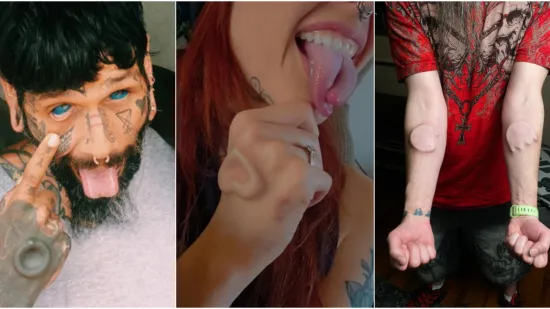 Ljudi su podijelili svoje najbizarnije modifikacije na tijelu: Neke su ba&scaron; zastra&scaron;ujuće