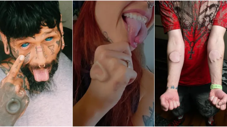 Ljudi su podijelili svoje najbizarnije modifikacije na tijelu: Neke su ba&scaron; zastra&scaron;ujuće