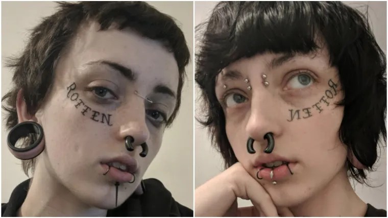 Najteži period u životu doveo je do ekstremnog zahvata: Evo kako danas izgleda